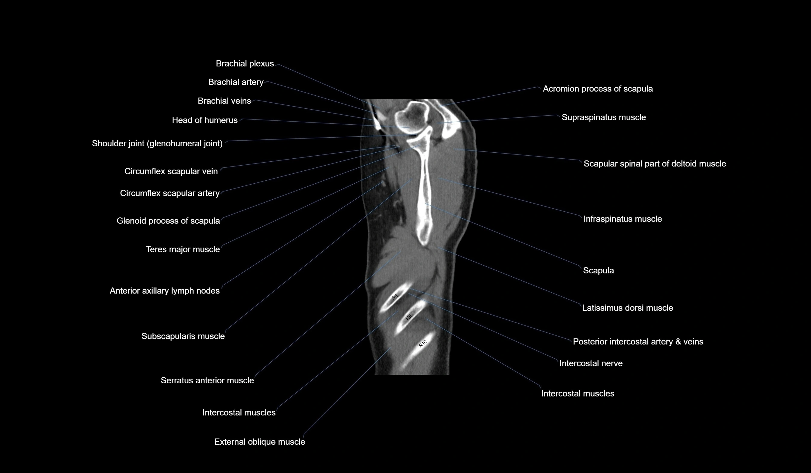 CT chest (thorax) soft tissue window labelled sagittal cross sectional anatomy radiology image-00011.webp